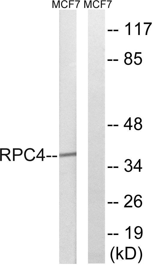 POLR3D Rabbit Polyclonal Antibody