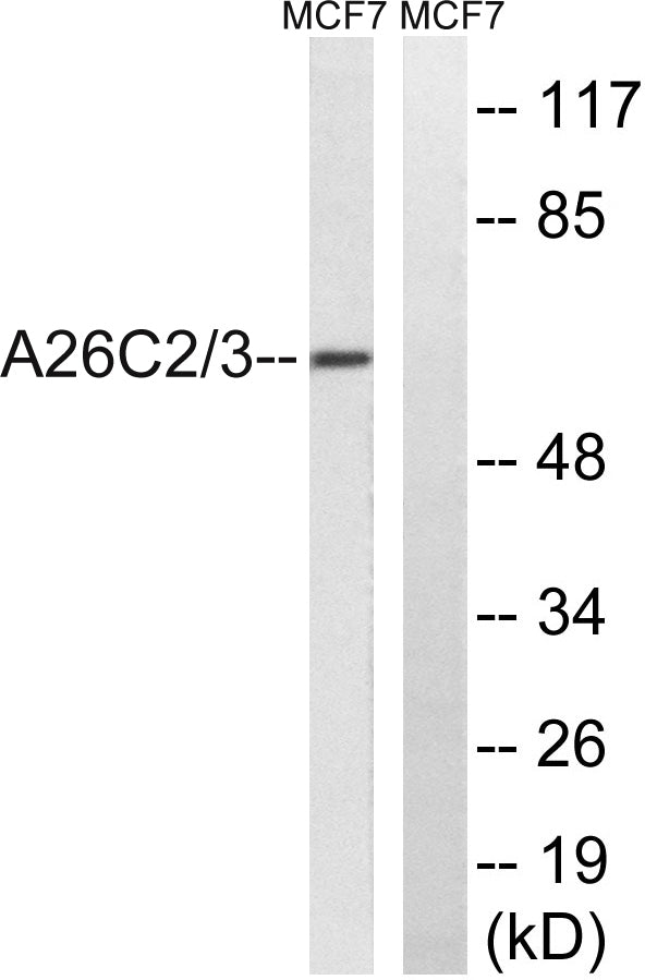 POTE-14/22 Rabbit Polyclonal Antibody