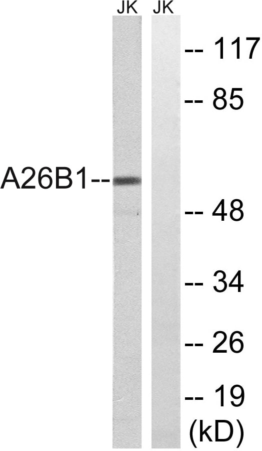 POTE15 Rabbit Polyclonal Antibody