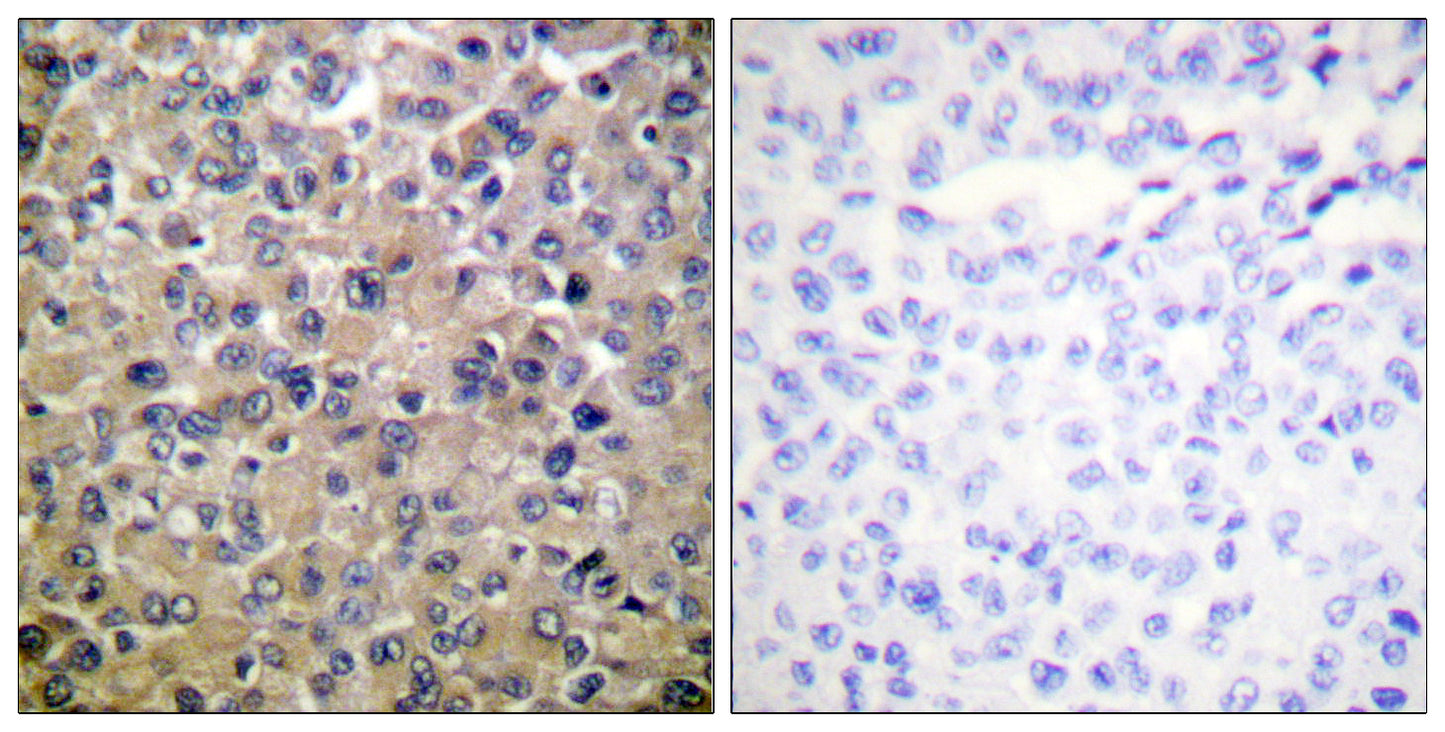 PP1α Rabbit Polyclonal Antibody