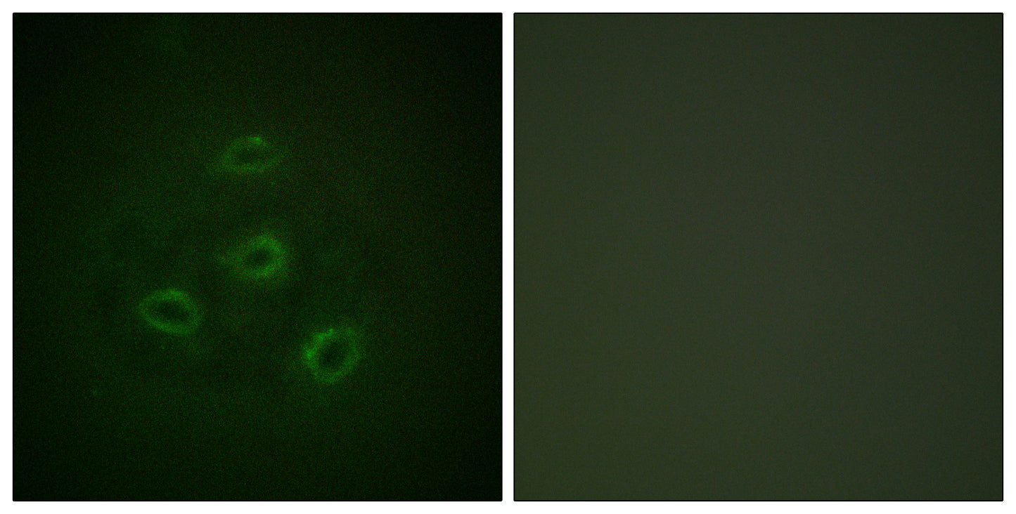 PP2A-Cα Rabbit Polyclonal Antibody