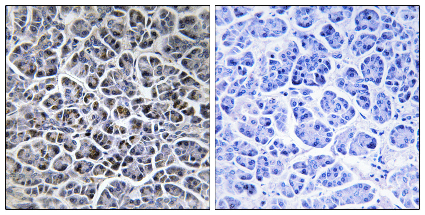 PP2Cκ Rabbit Polyclonal Antibody