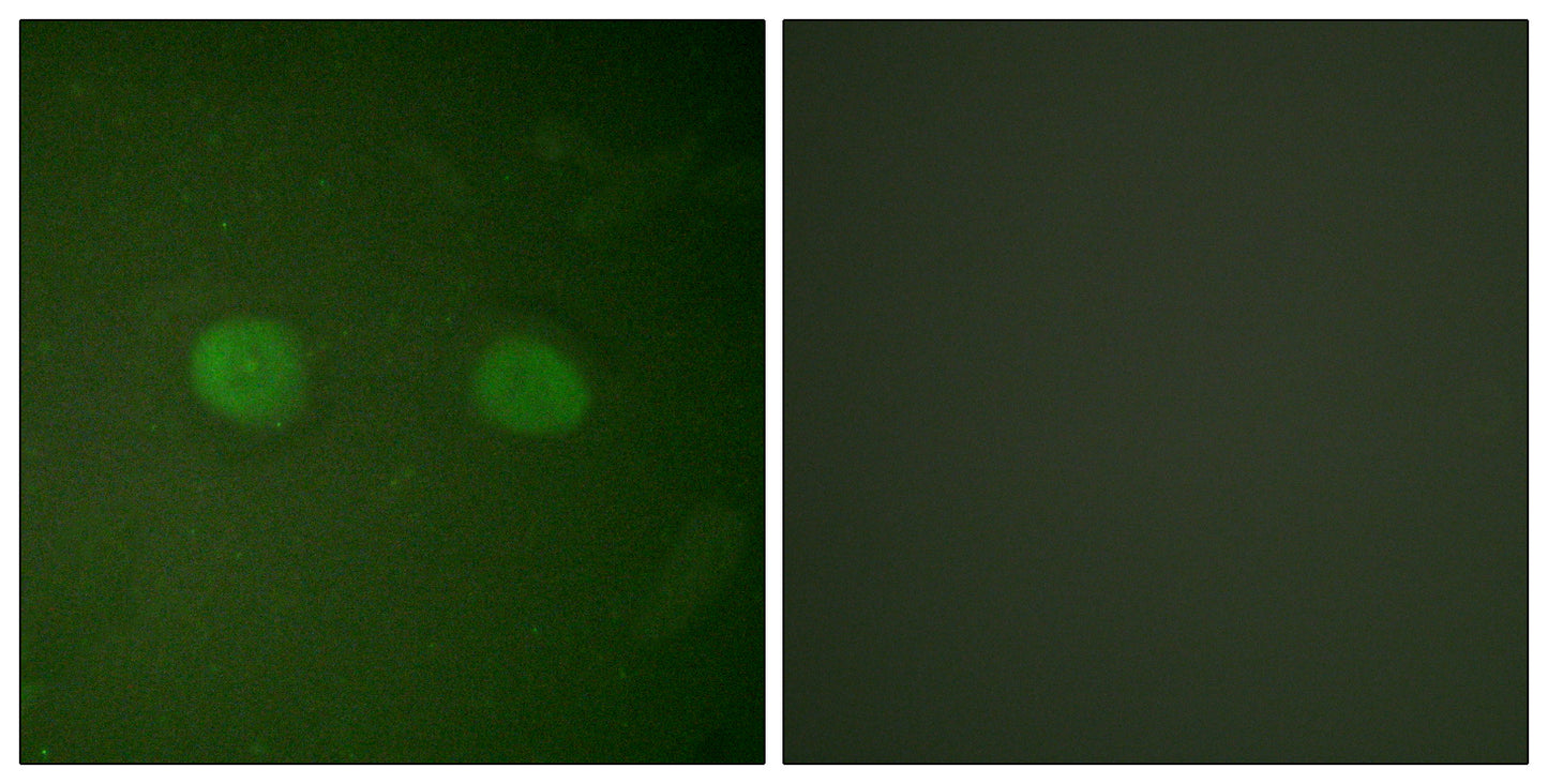 PPAR-α Rabbit Polyclonal Antibody