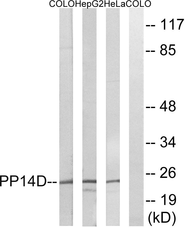 PPP1R14D Rabbit Polyclonal Antibody