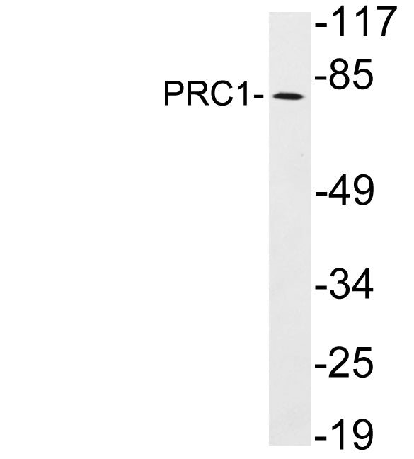 PRC1 Rabbit Polyclonal Antibody
