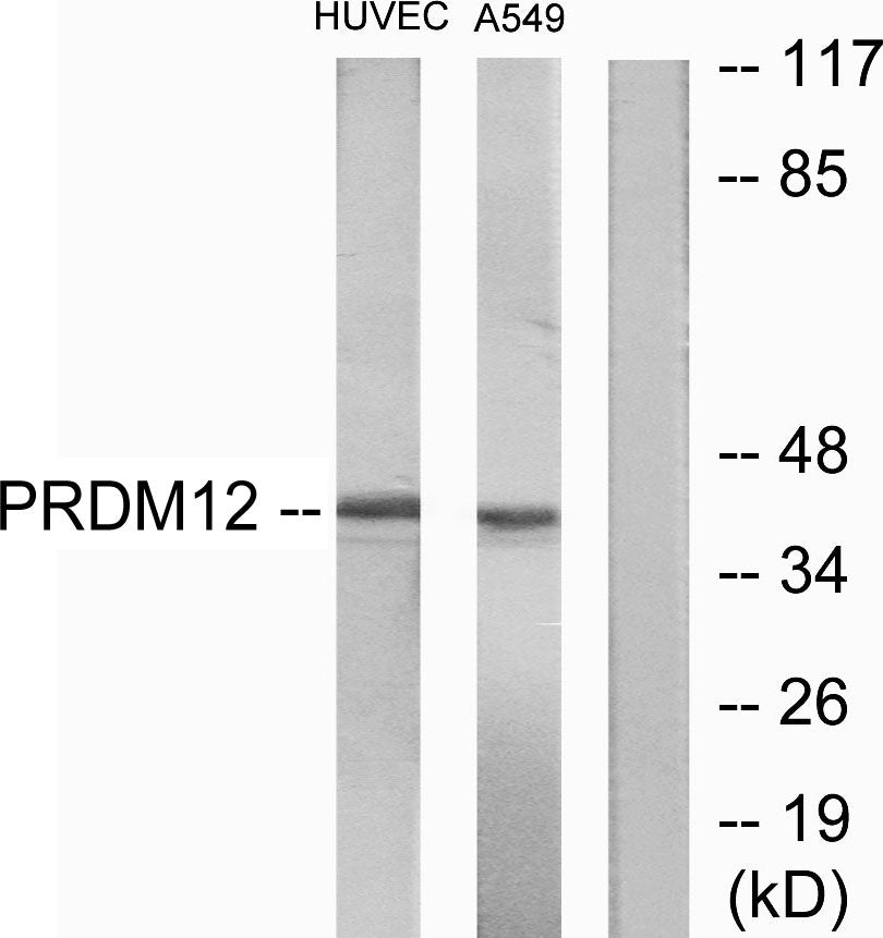PRDM12 Rabbit Polyclonal Antibody