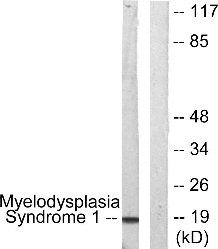 PRDM3 Rabbit Polyclonal Antibody