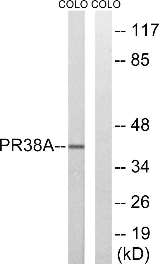 PRPF38A Rabbit Polyclonal Antibody