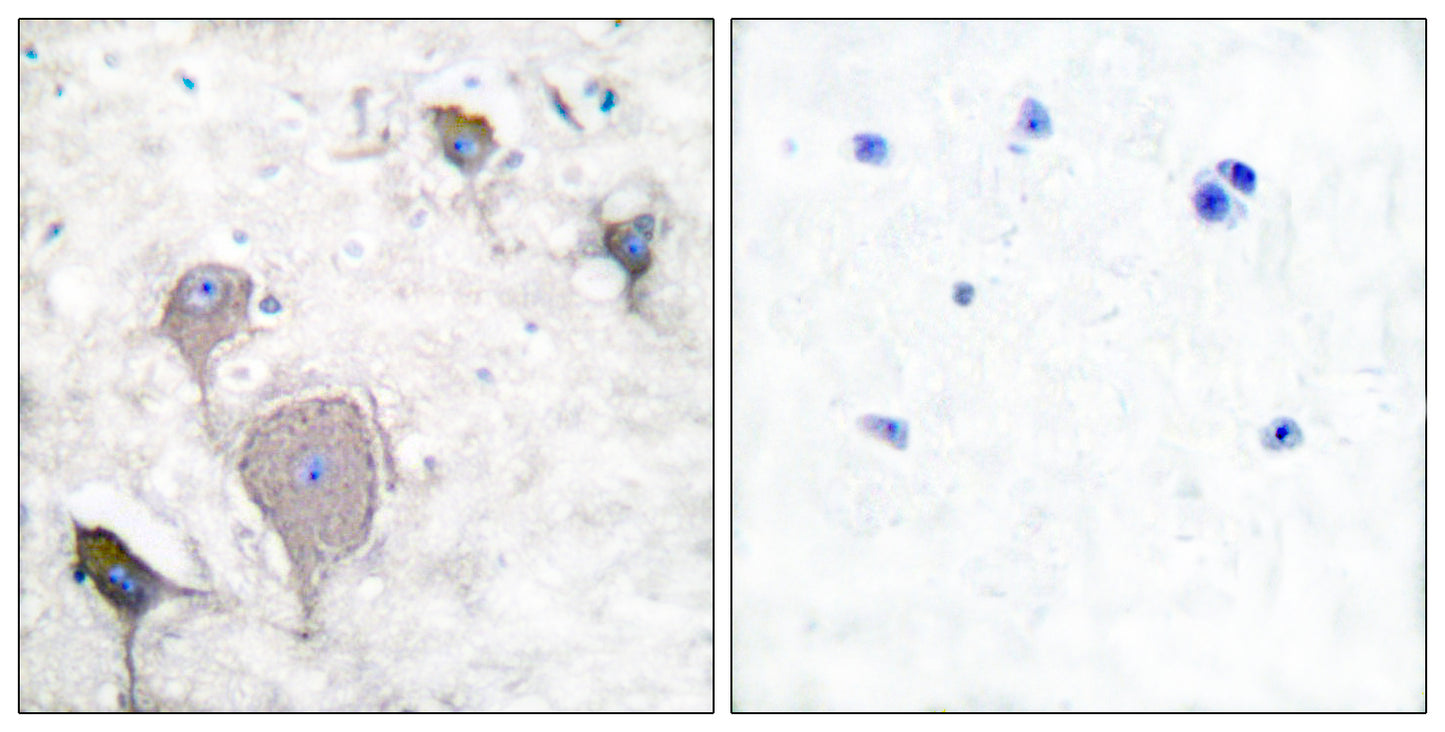 PRPH Rabbit Polyclonal Antibody