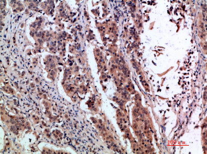 pS2 Rabbit Polyclonal Antibody