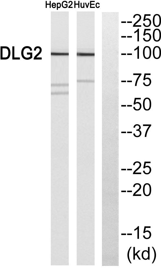 PSD-93 Rabbit Polyclonal Antibody