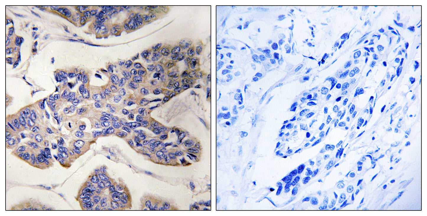 PSK2 Rabbit Polyclonal Antibody
