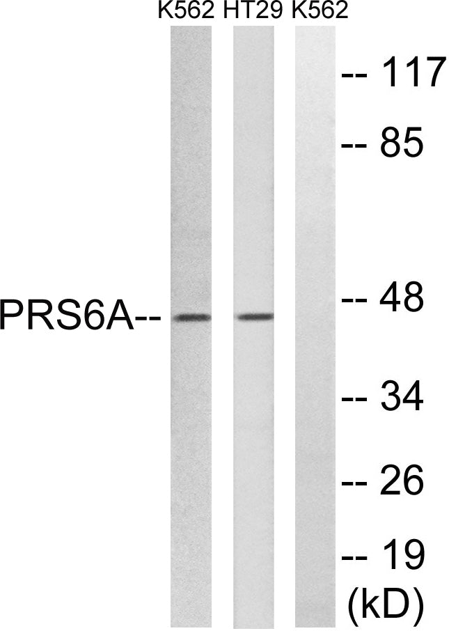 PSMC3 Rabbit Polyclonal Antibody