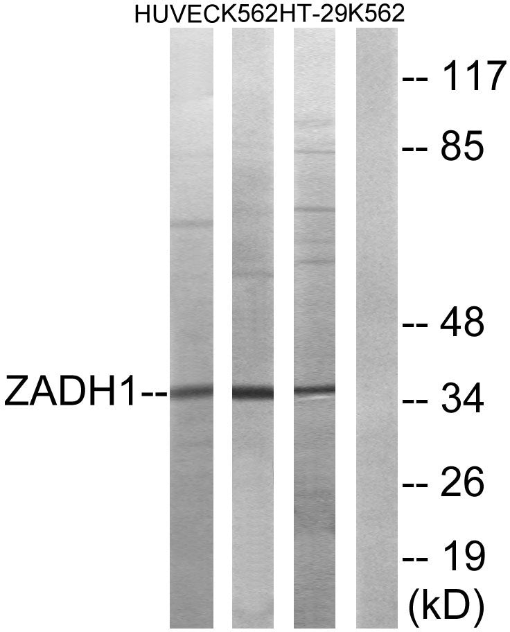 PTGR2 Rabbit Polyclonal Antibody