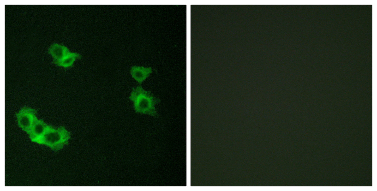 PTH/PTHrP-R Rabbit Polyclonal Antibody