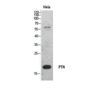 PTN Rabbit Polyclonal Antibody