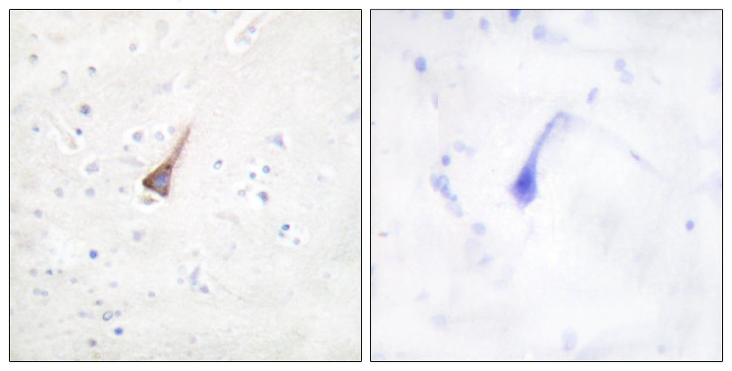 PTP1B Rabbit Polyclonal Antibody