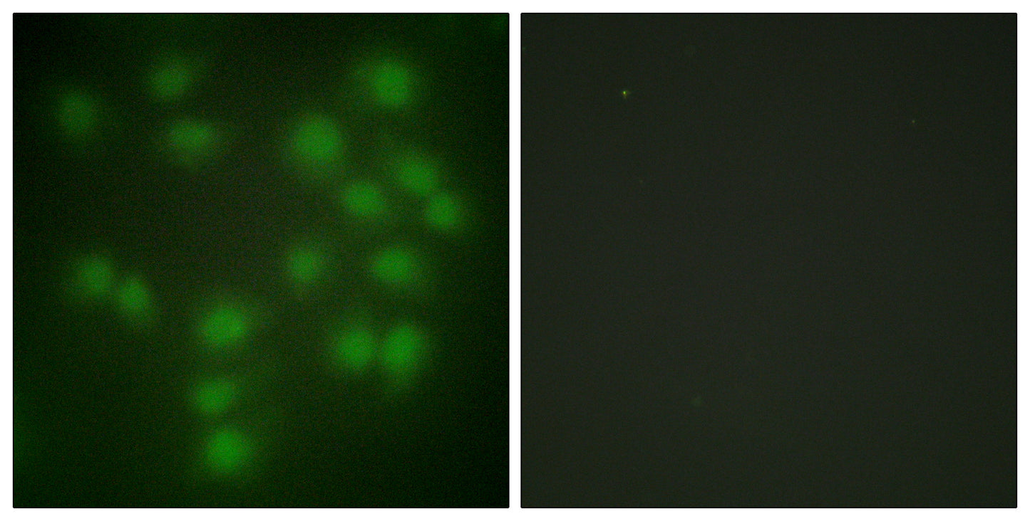 PTTG1/2/3 Rabbit Polyclonal Antibody