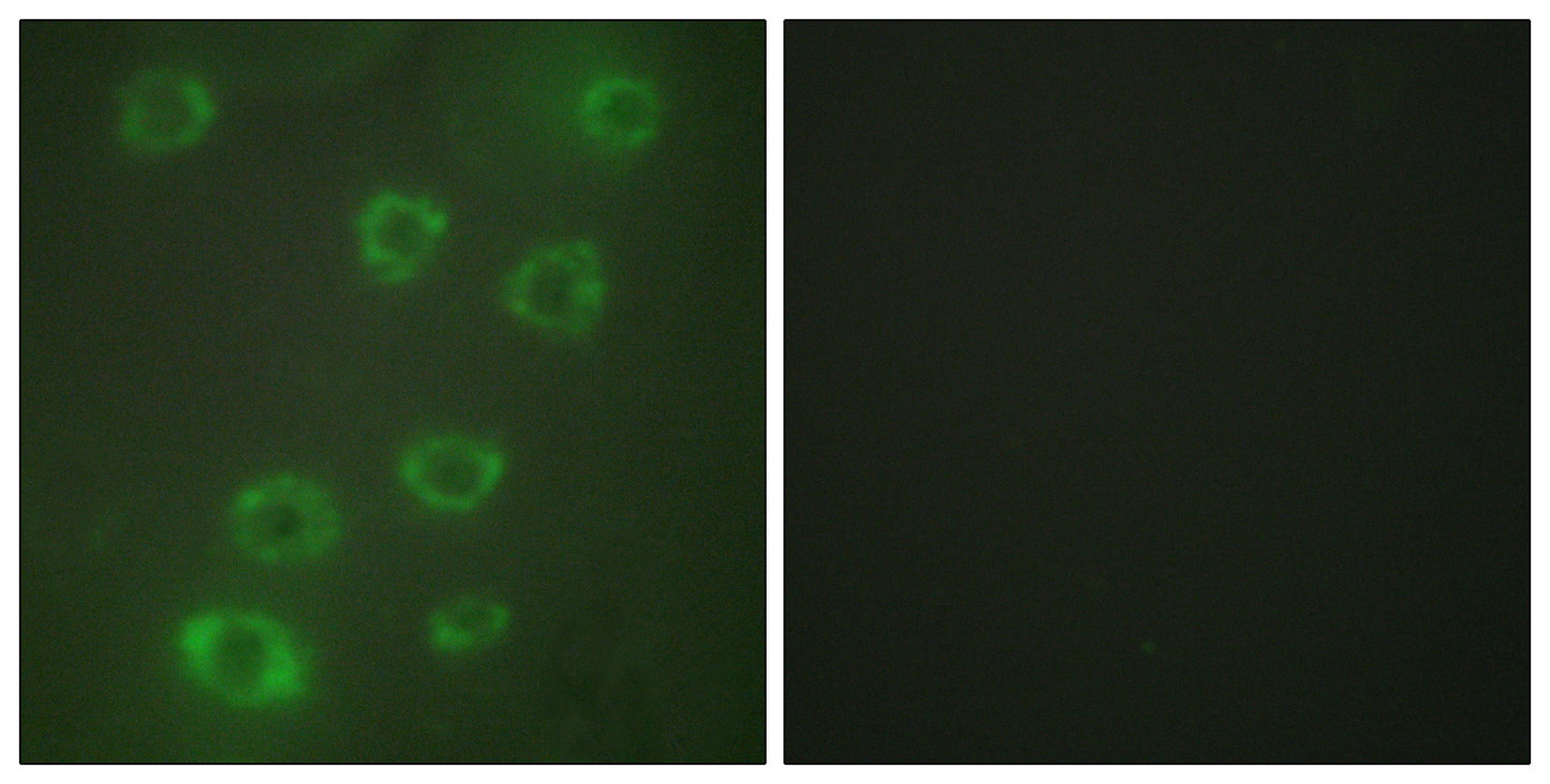 Ptx3 Rabbit Polyclonal Antibody