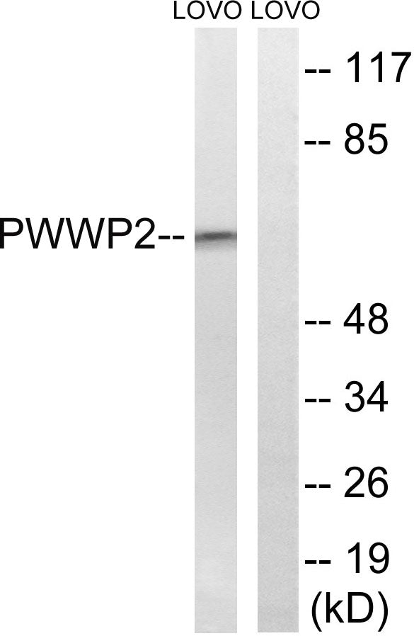 PWWP2B Rabbit Polyclonal Antibody