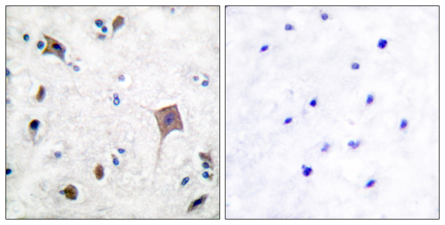 PYK2 Rabbit Polyclonal Antibody