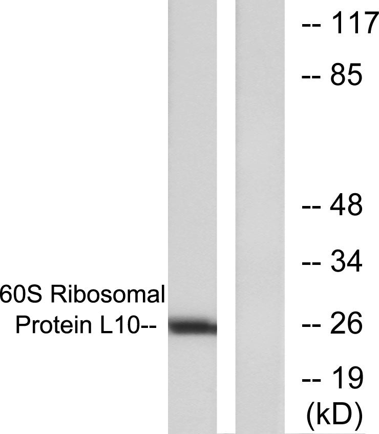 QM Rabbit Polyclonal Antibody