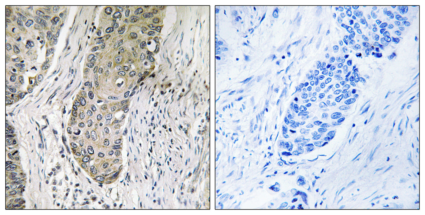 QSK Rabbit Polyclonal Antibody