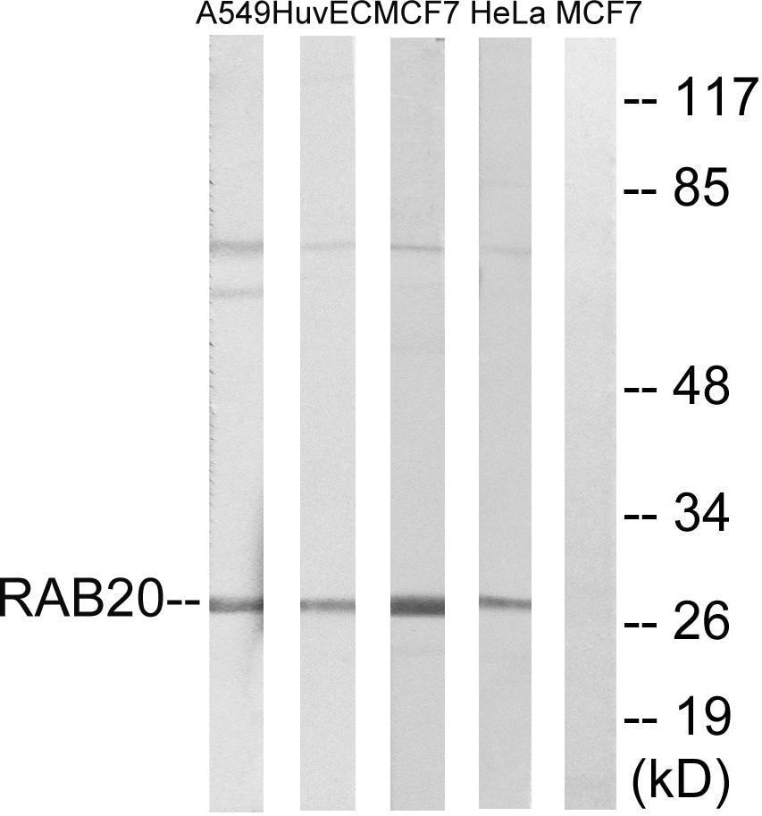 Rab 20 Rabbit Polyclonal Antibody