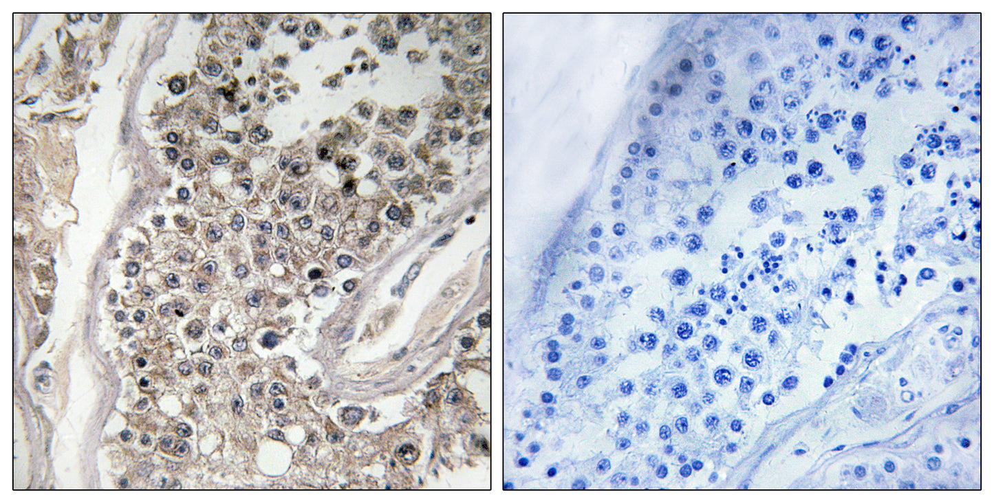 Rab 3 GAP p130 Rabbit Polyclonal Antibody