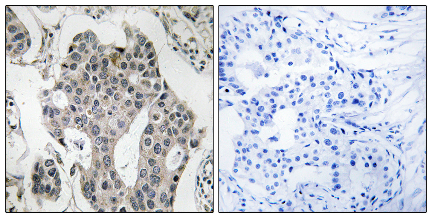 Rab 3 GAP p150 Rabbit Polyclonal Antibody