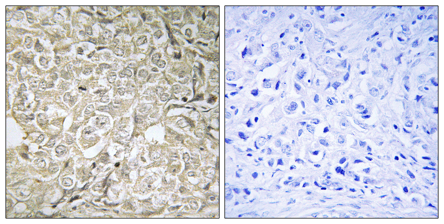 Rab 37 Rabbit Polyclonal Antibody