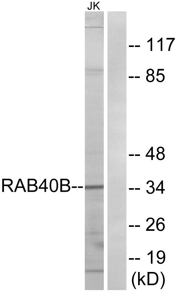 Rab 40B Rabbit Polyclonal Antibody