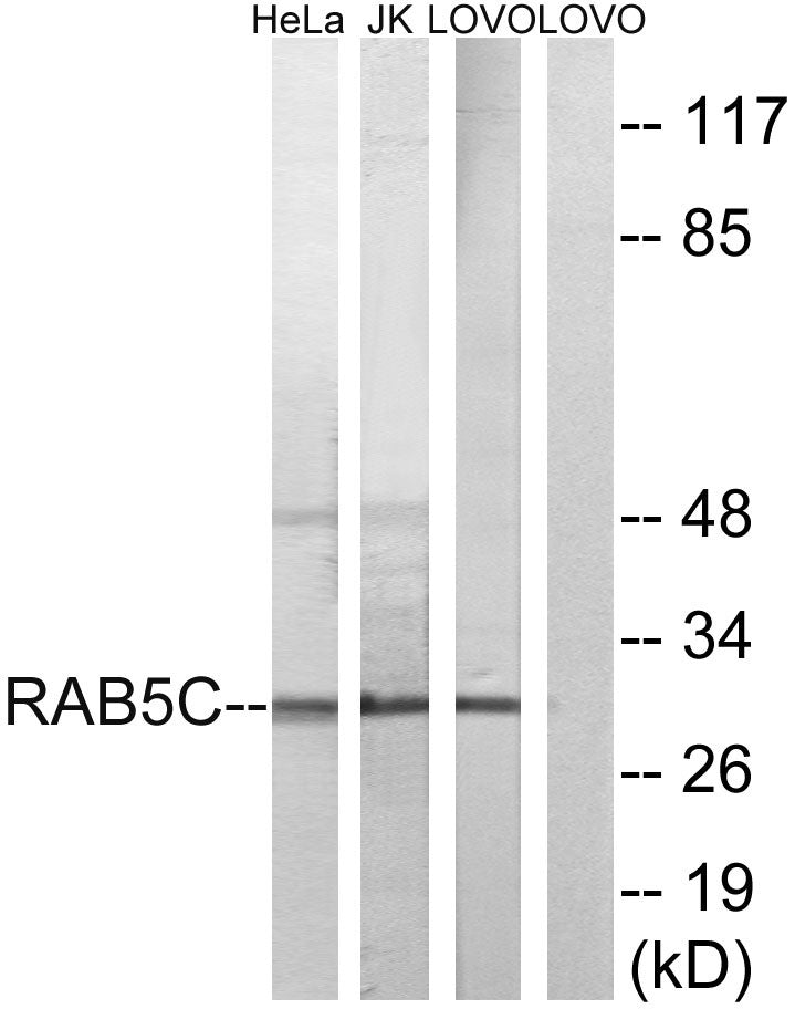 Rab 5C Rabbit Polyclonal Antibody