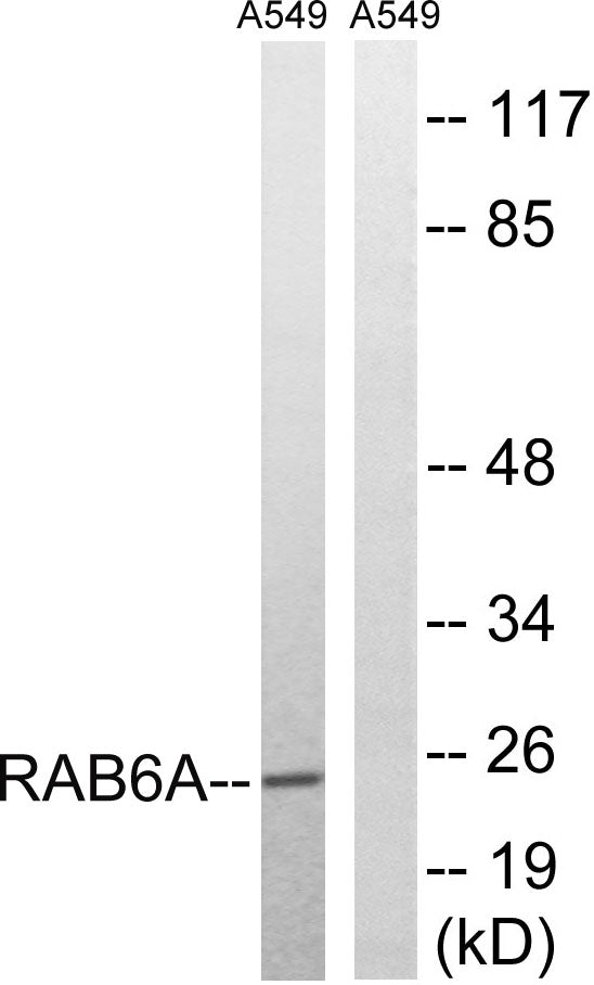 Rab 6A Rabbit Polyclonal Antibody