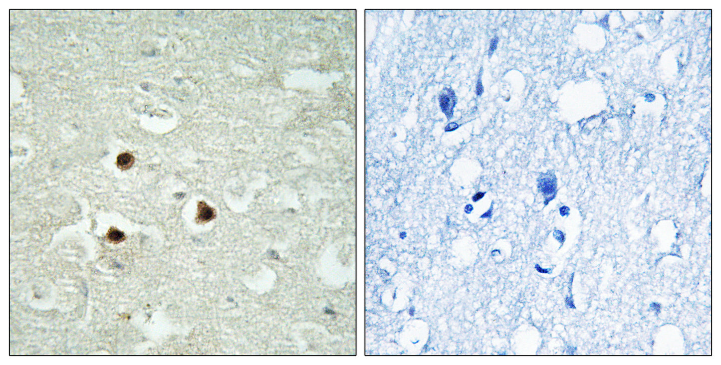 RAB3IP Rabbit Polyclonal Antibody