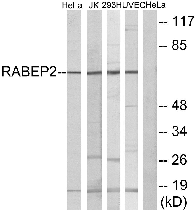 Rabaptin-5β Rabbit Polyclonal Antibody