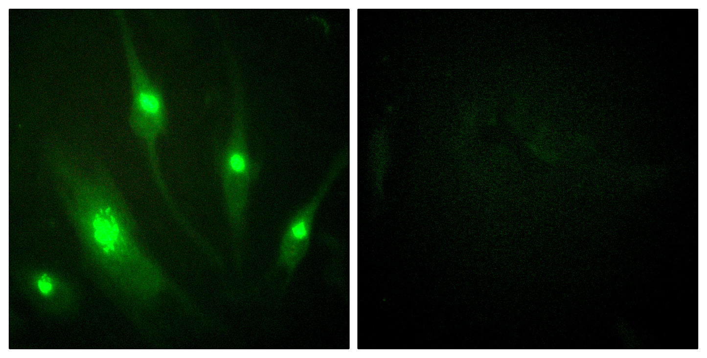 Rac GAP1 Rabbit Polyclonal Antibody