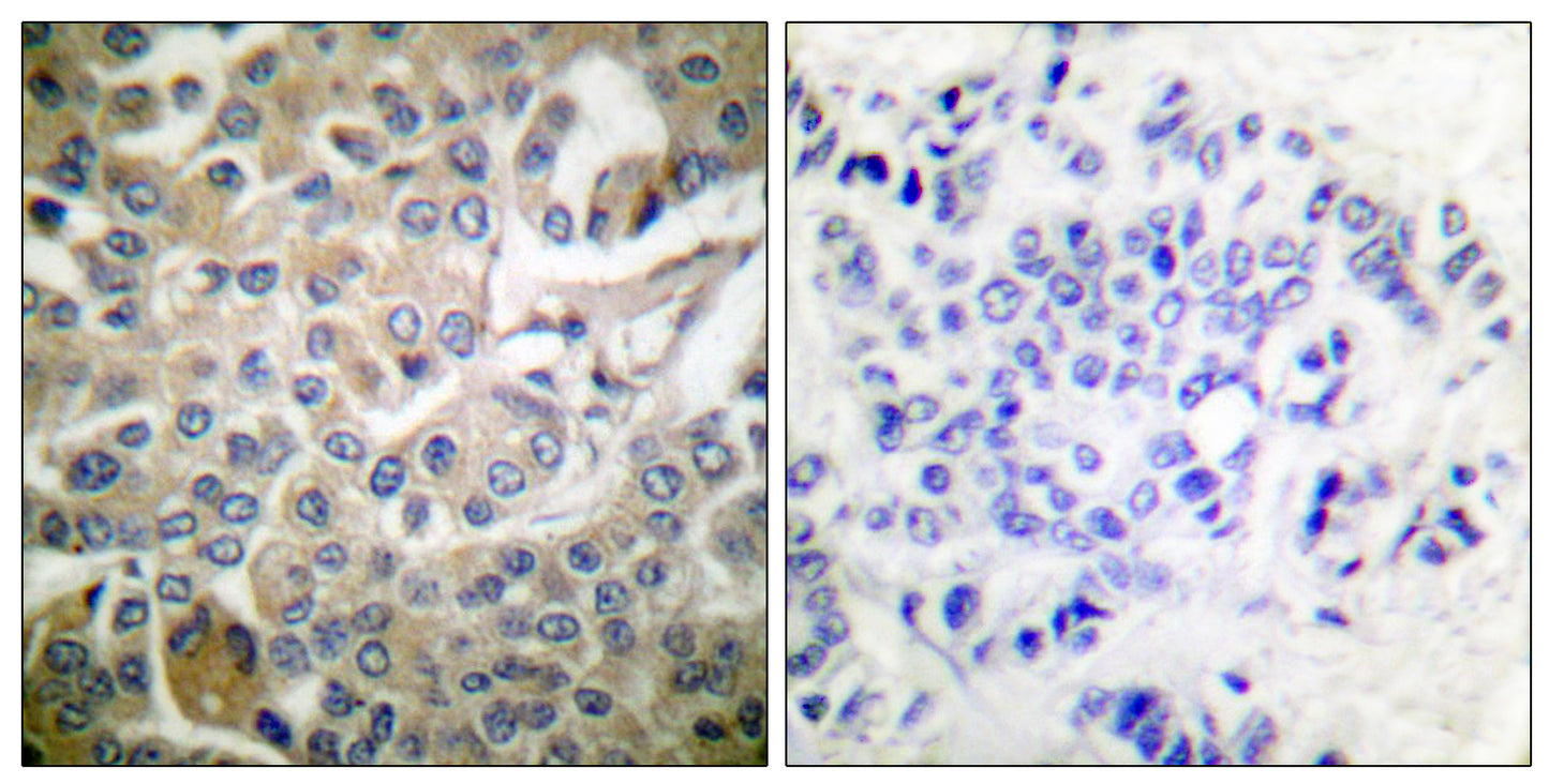 Rac1/2/3/CDC42 Rabbit Polyclonal Antibody