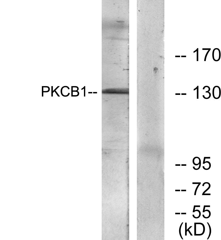RACK7 Rabbit Polyclonal Antibody