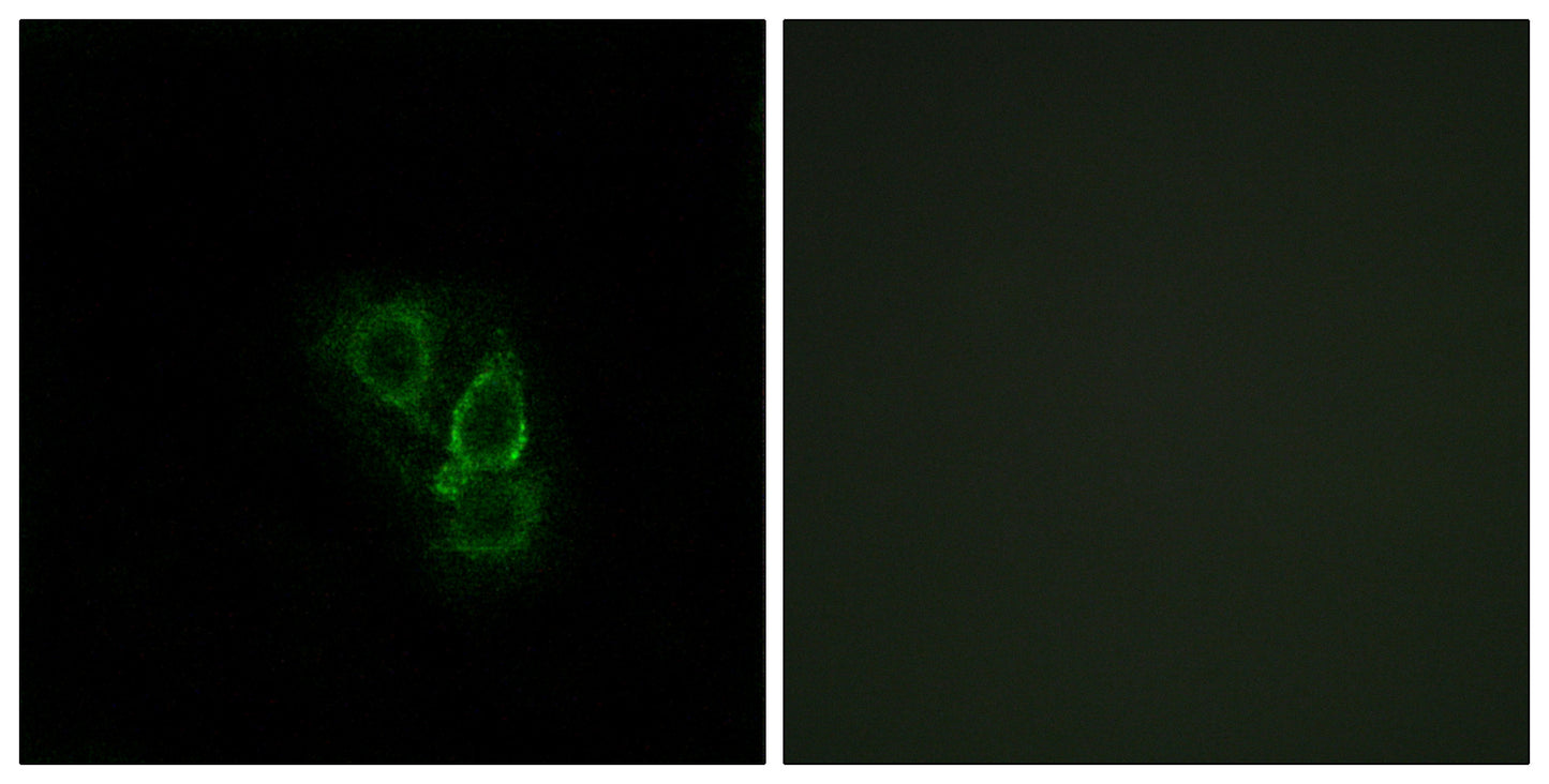 Rad GTPase Rabbit Polyclonal Antibody
