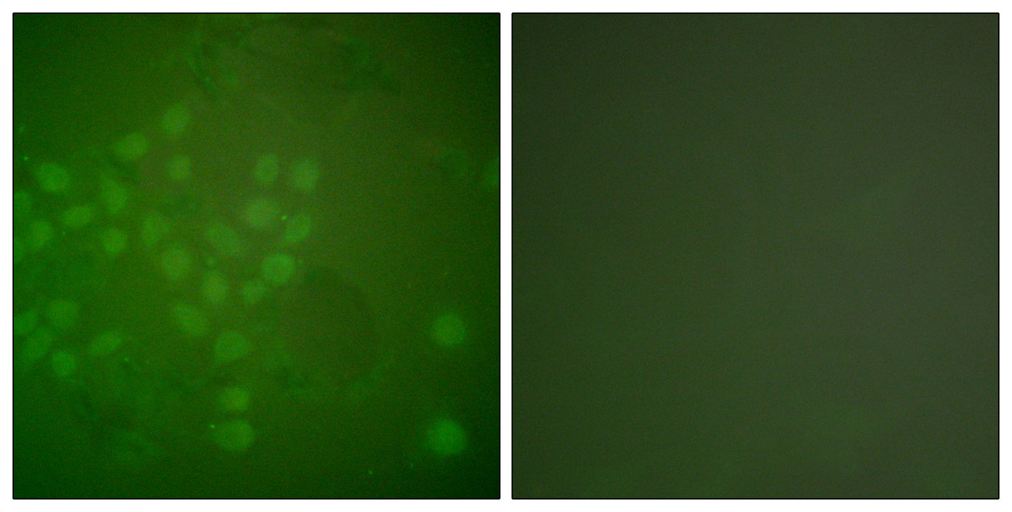 Rad17 Rabbit Polyclonal Antibody