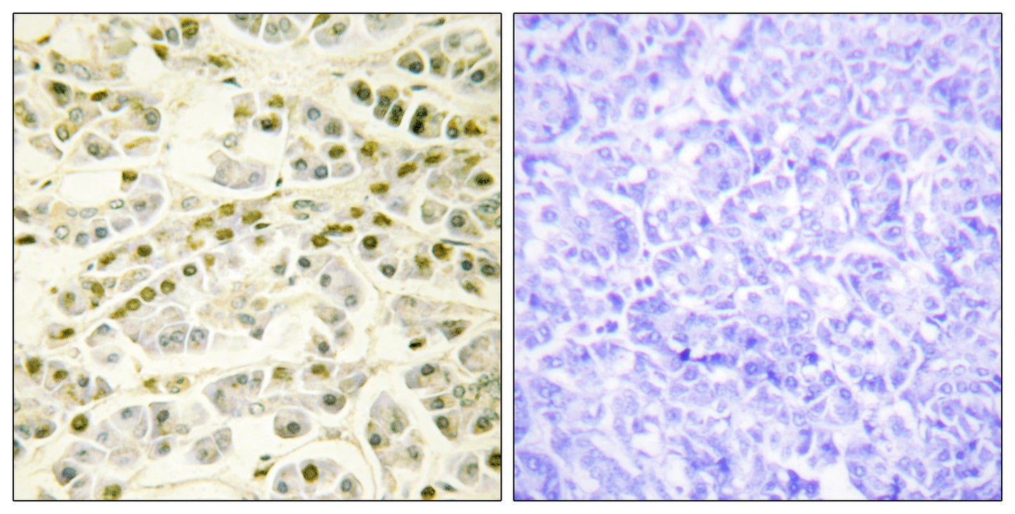 Rad51B Rabbit Polyclonal Antibody