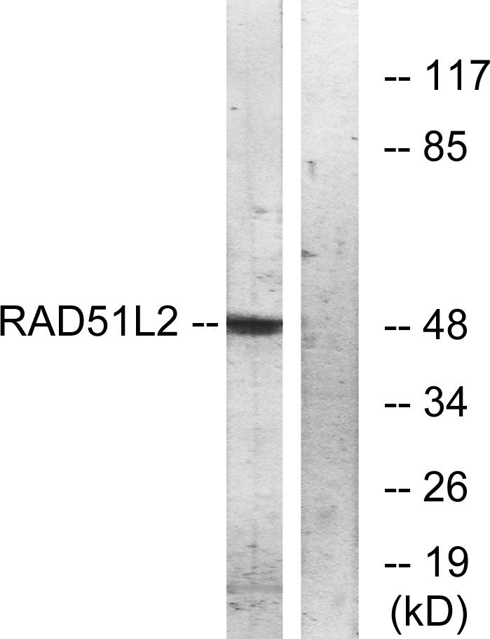 Rad51C Rabbit Polyclonal Antibody