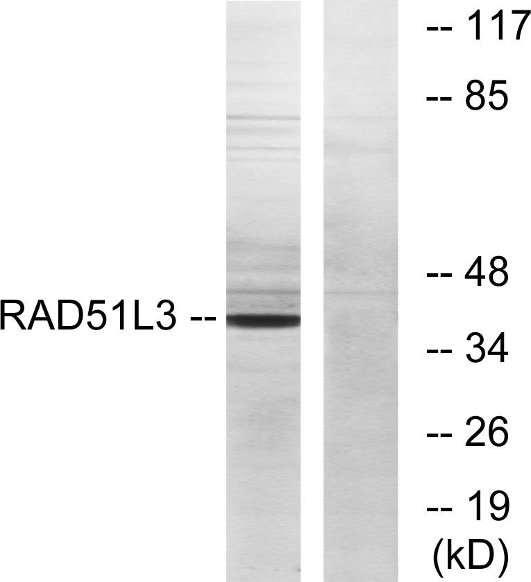 Rad51D Rabbit Polyclonal Antibody
