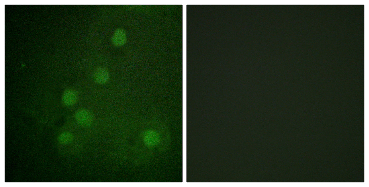 Rad52 Rabbit Polyclonal Antibody