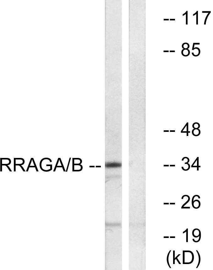 Rag A/B Rabbit Polyclonal Antibody