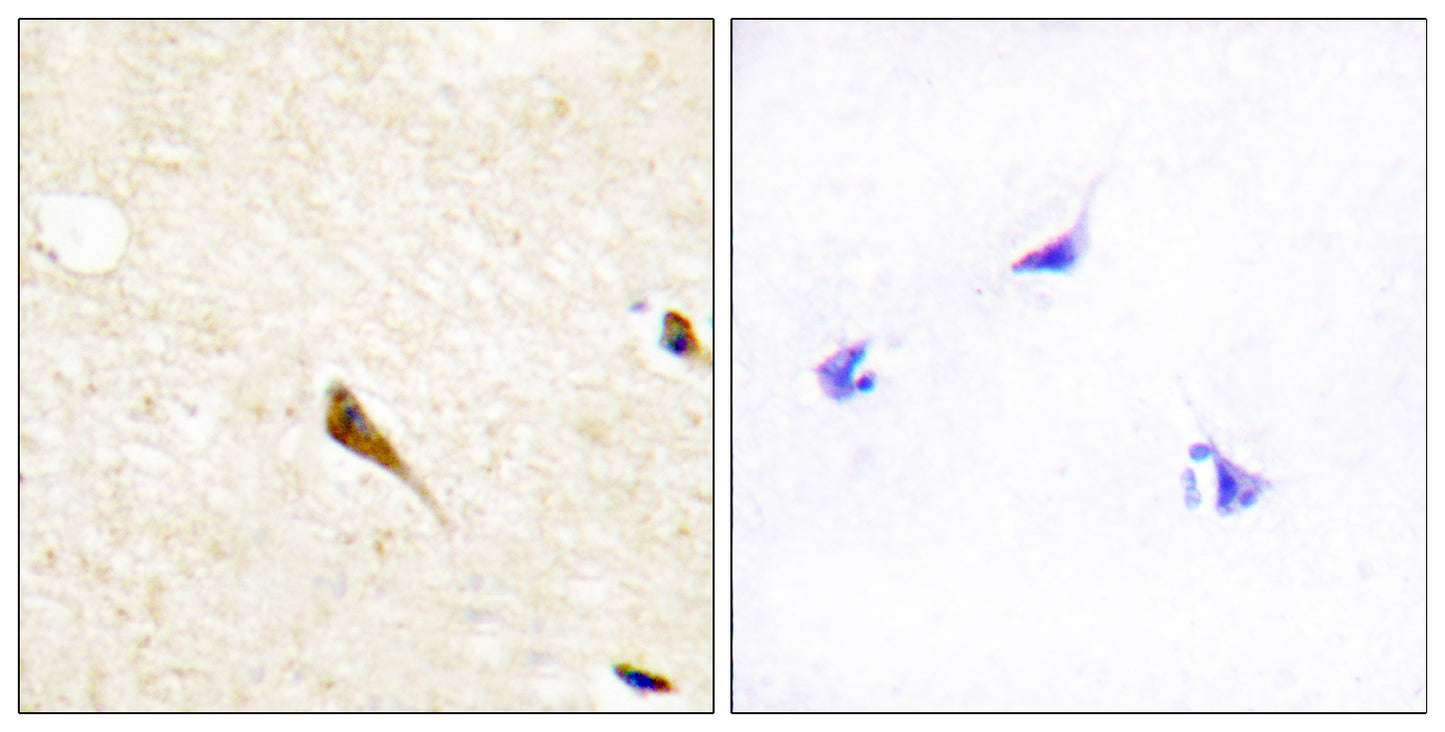 RAGE Rabbit Polyclonal Antibody
