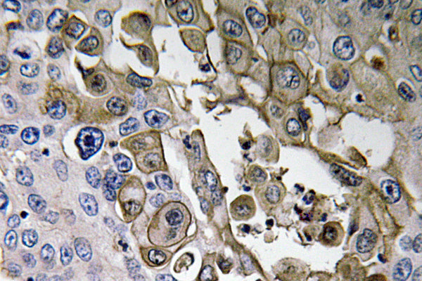 RAGE Rabbit Polyclonal Antibody
