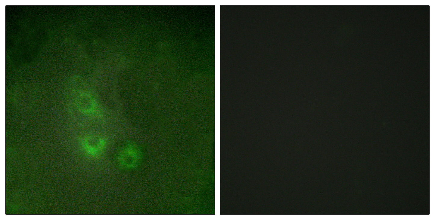 Rak Rabbit Polyclonal Antibody