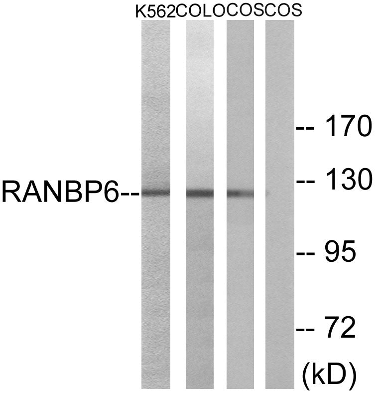 Ran BP-6 Rabbit Polyclonal Antibody